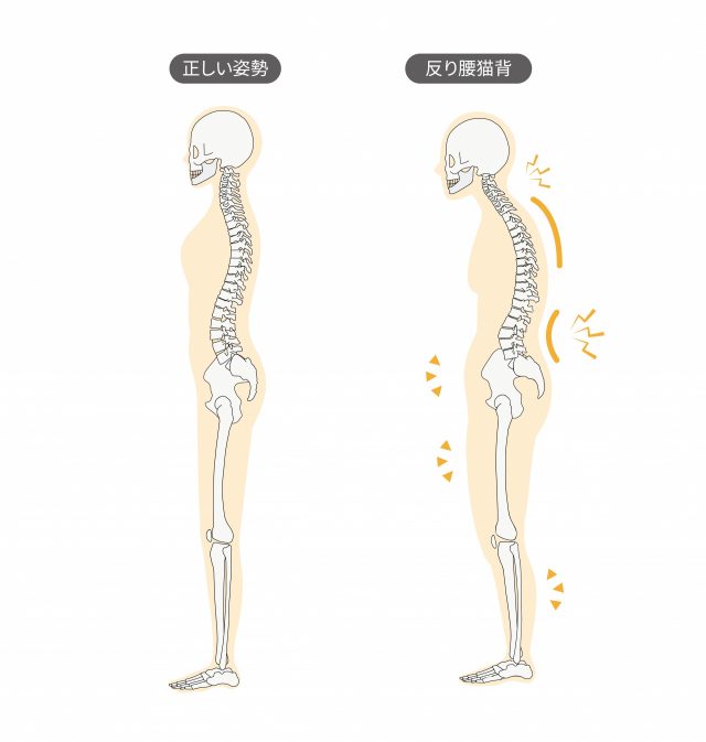 姿勢を改善するメリット